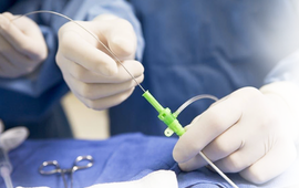 Rediscover Life's Rhythm with Angioplasty at St. Luke's Medical Center