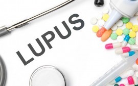 Understanding Lupus