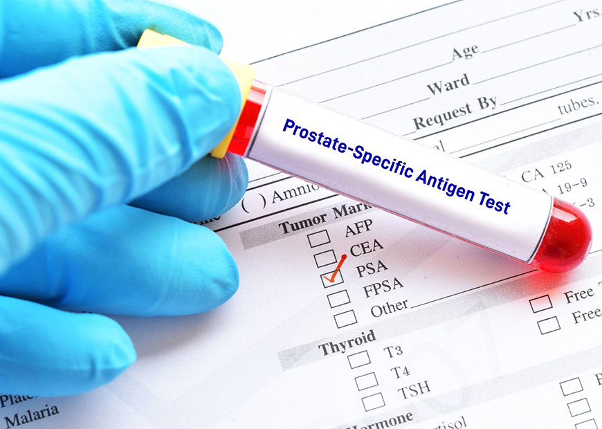  



A simple Prostate-Specific Antigen (PSA) blood test can make a big difference in preventing the progression of prostate cancer.