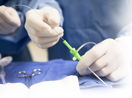 Intravascular Ultrasound (IVUS) at St. Luke's: Advanced Imaging for Precise Angioplasty