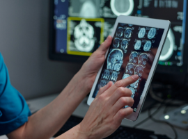 Screening Cranial MRI: Fast, Accurate Brain Health Assessment Banner