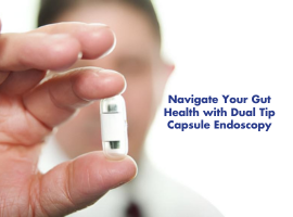 Navigate Your Gut Health with Dual Tip Capsule Endoscopy Banner