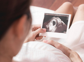 Special Prenatal Maternity Gift for Expectant Mothers at St. Luke’s Medical Center Banner