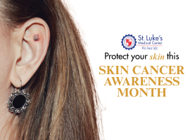 Understanding Basal Cell Carcinoma (BCC) Banner