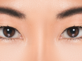 Why Choose SMILE (SMile Incision Lenticule Extraction) Banner