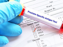 St. Luke’s offers 15% discount for prostate cancer prevention procedures Banner